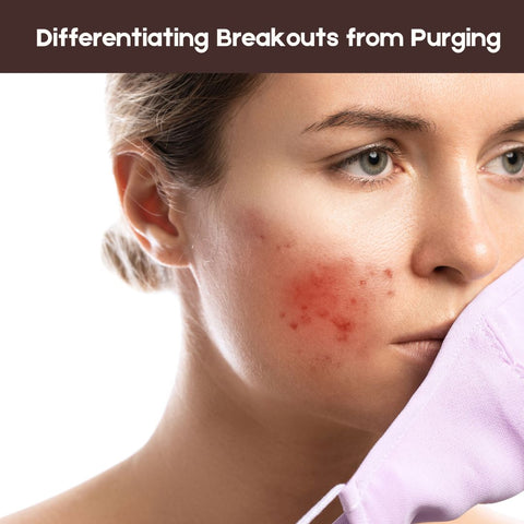 Differentiating Breakouts from Purging
