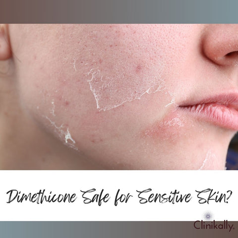 Dimethicone Safe for Sensitive Skin?