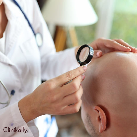 Discussing the importance of consulting a dermatologist before starting topical finasteride therapy