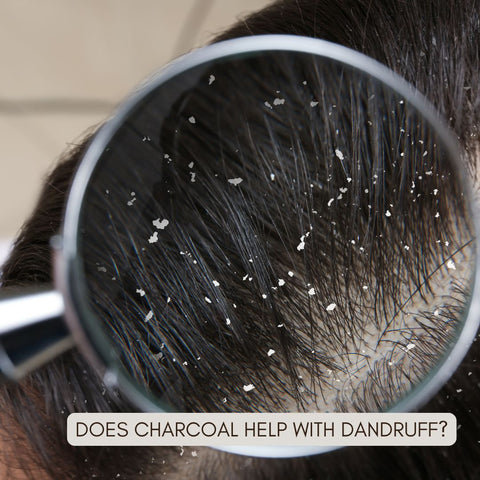 Does Charcoal Help with Dandruff?