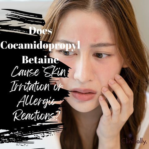 Does Cocamidopropyl Betaine Cause Skin Irritation or Allergic Reactions?
