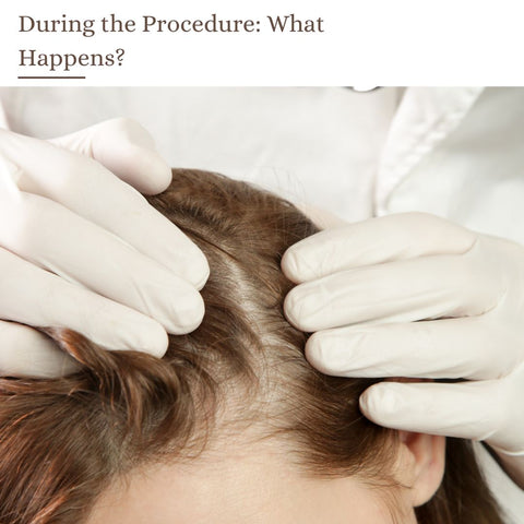 During the Procedure: What Happens?