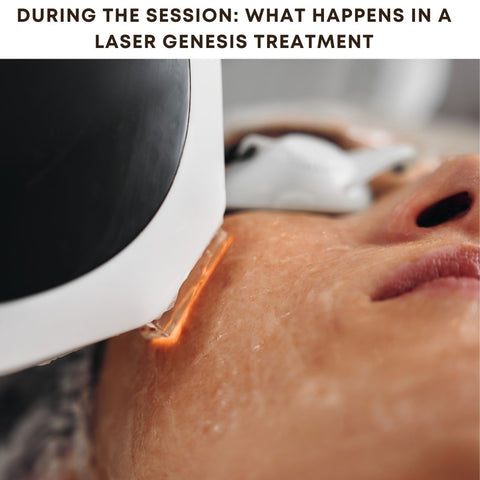 During the Session: What Happens in a Laser Genesis Treatment