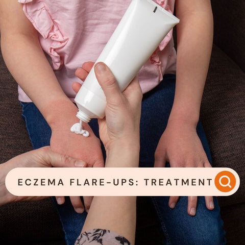 Eczema Flare-ups: Treatment