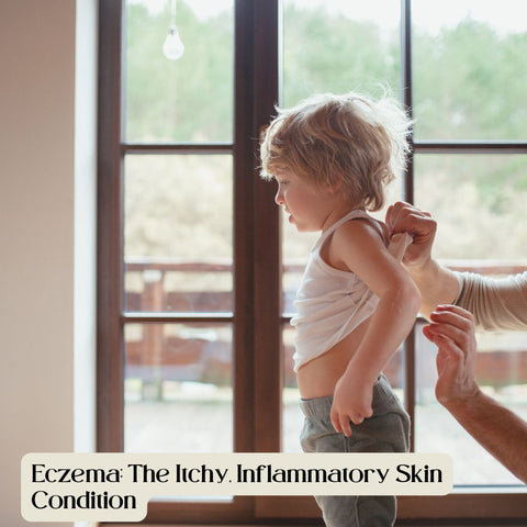 Eczema: The Itchy, Inflammatory Skin Condition