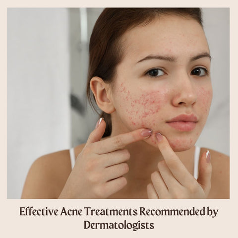 Effective Acne Treatments Recommended by Dermatologists