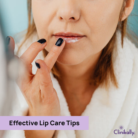 Effective Lip Care Tips for Cold Weather