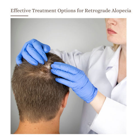 Effective Treatment Options for Retrograde Alopecia