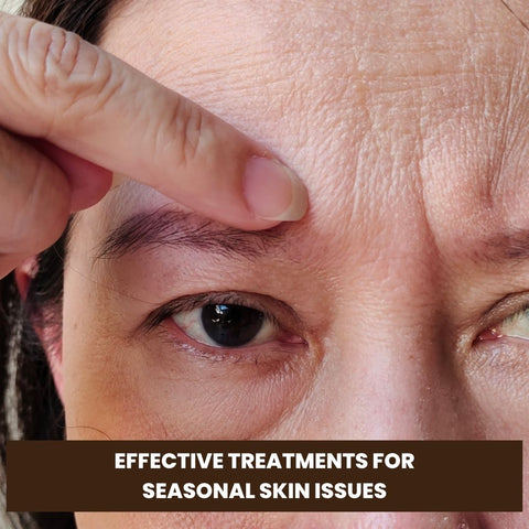 Effective Treatments for Seasonal Skin Issues