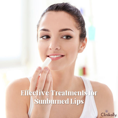 Effective Treatments for Sunburned Lips