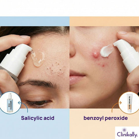 Effectiveness for Different Acne Types