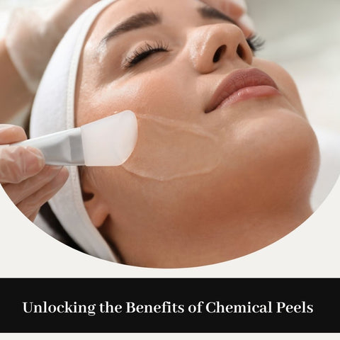 Unlocking the Benefits of Chemical Peels