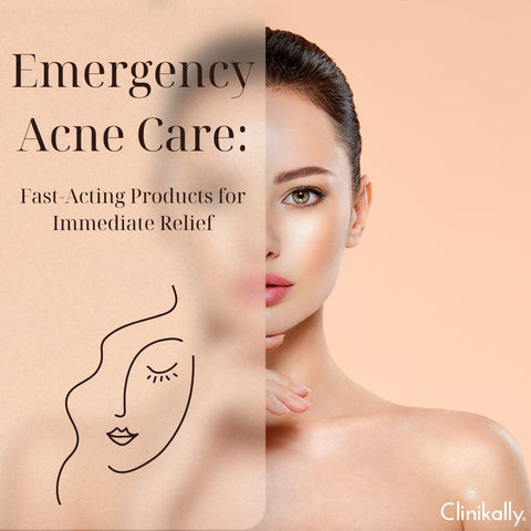 Emergency Acne Care: Fast-Acting Products for Immediate Relief