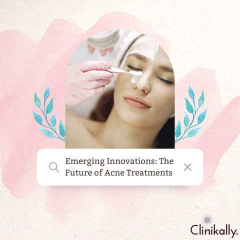 Emerging Innovations: The Future of Acne Treatments
