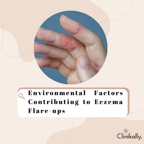 Environmental Factors Contributing to Eczema Flare-ups