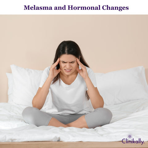 Melasma and Hormonal Changes: Managing Skin Pigmentation During Life Phases