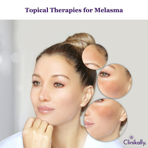 Pharmacological and Topical Therapies