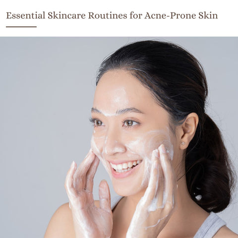 Essential Skincare Routines for Acne-Prone Skin