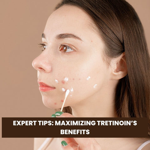 Expert Tips: Maximizing Tretinoin’s Benefits