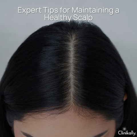 Expert Tips for Maintaining a Healthy Scalp