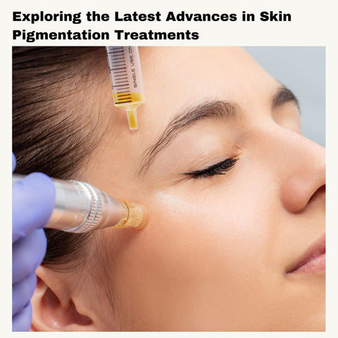 Exploring the Latest Advances in Skin Pigmentation Treatments
