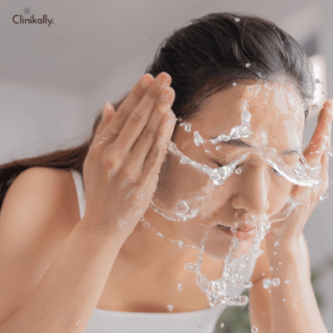 face wash for pimples and oily skin