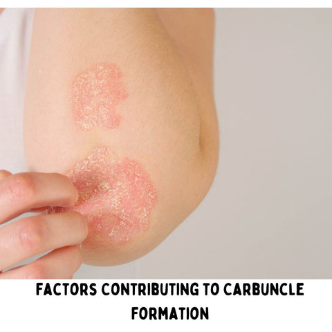 Factors Contributing to Carbuncle Formation