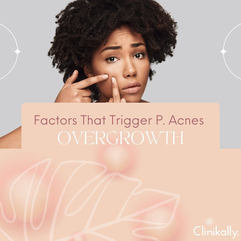Factors That Trigger P. Acnes Overgrowth