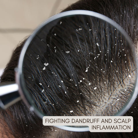 Fighting Dandruff and Scalp Inflammation
