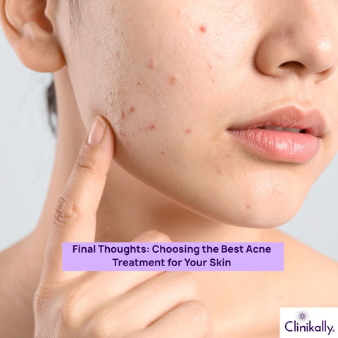 Choosing the Best Acne Treatment for Your Skin