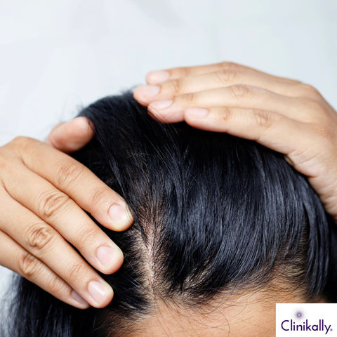 Healthy scalp and hair close-up