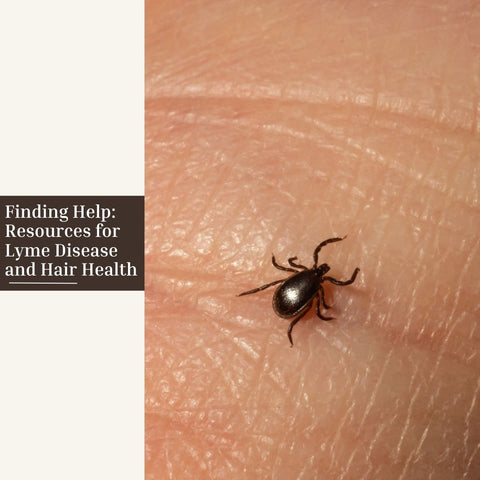 Finding Help: Resources for Lyme Disease and Hair Health