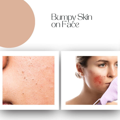 Bumpy Skin on Face