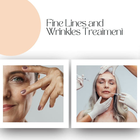 Fine Lines and Wrinkles Treatment