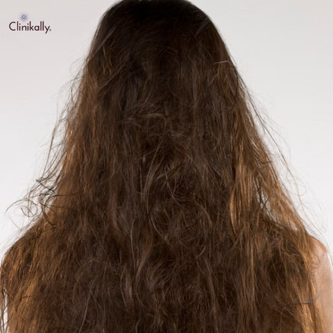 Is eugenol good for your hair?