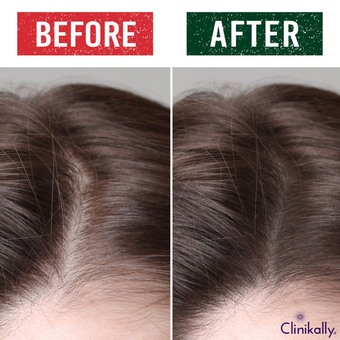 Hair volume before and after