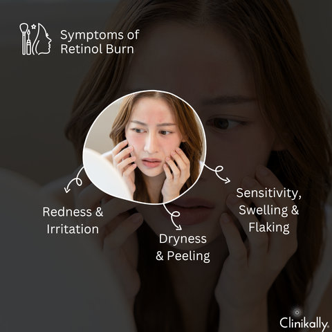 Symptoms of retinol burn