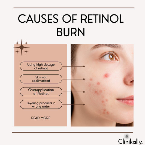 Causes of retinol burn
