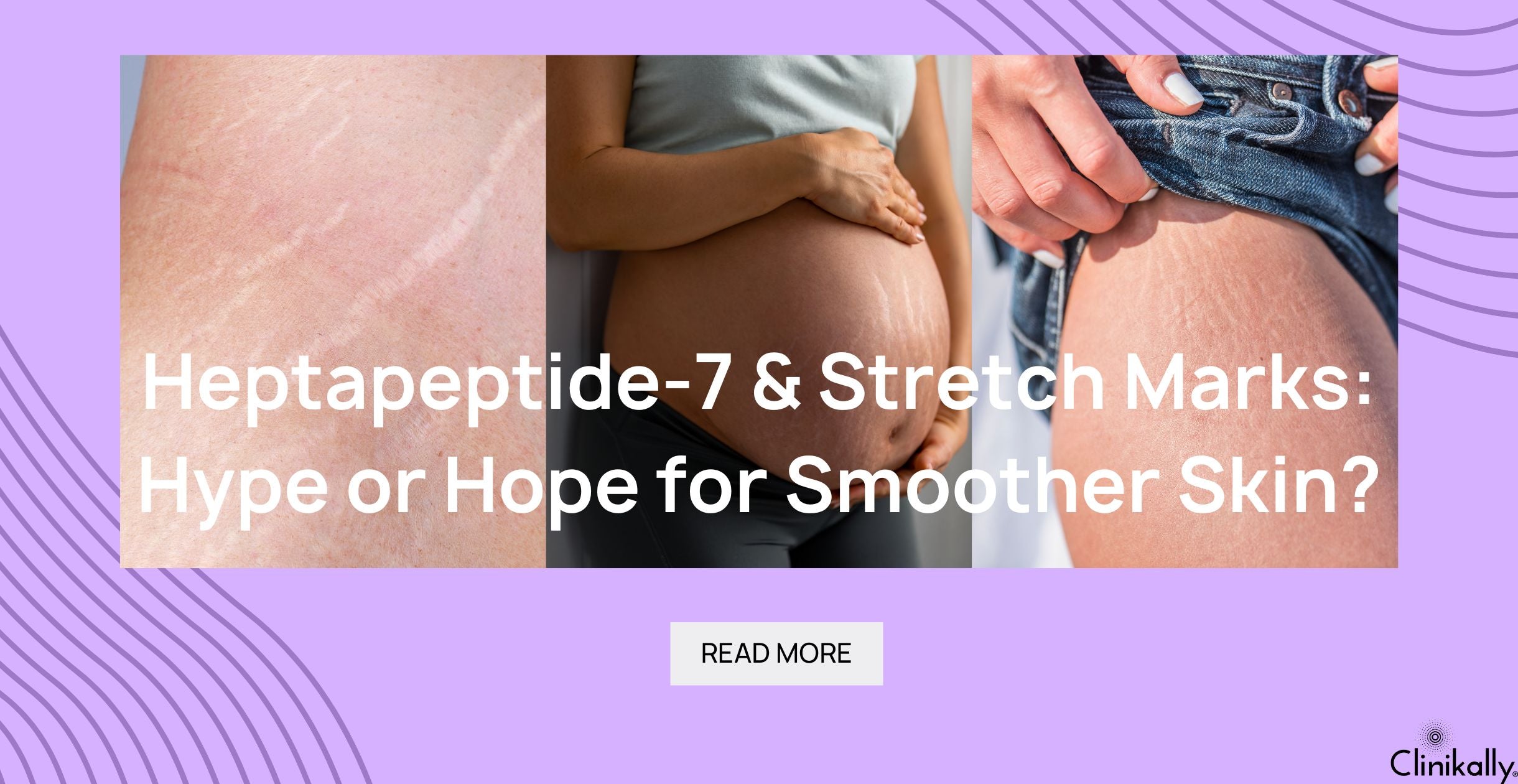 bpc 157 stretch marks Heptapeptide-7 & Marks: Hype or Hope for skin? how to administer b12