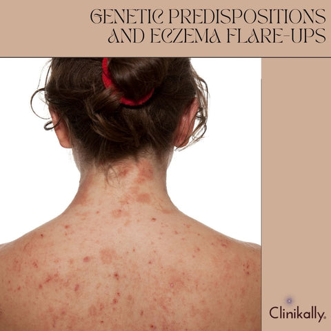 Genetic Predispositions and Eczema Flare-ups