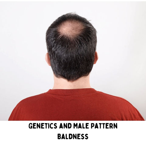 Genetics and Male Pattern Baldness