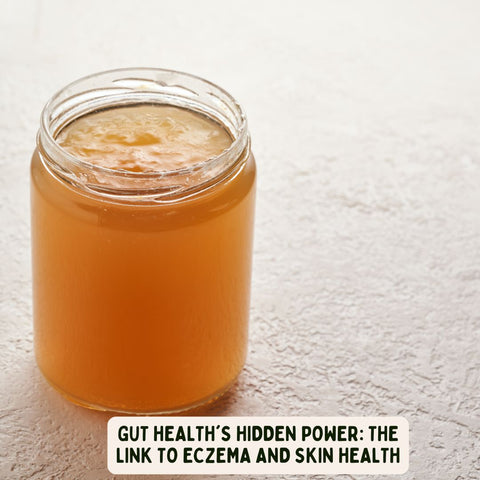 Gut Health's Hidden Power: The Link to Eczema and Skin Health