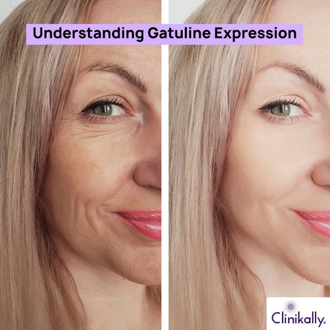 Understanding Gatuline Expression