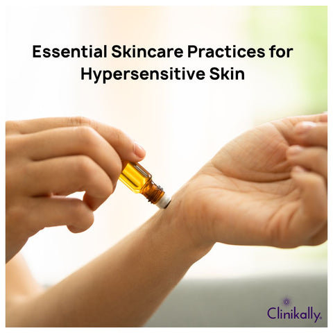 Essential Skincare Practices for Hypersensitive Skin