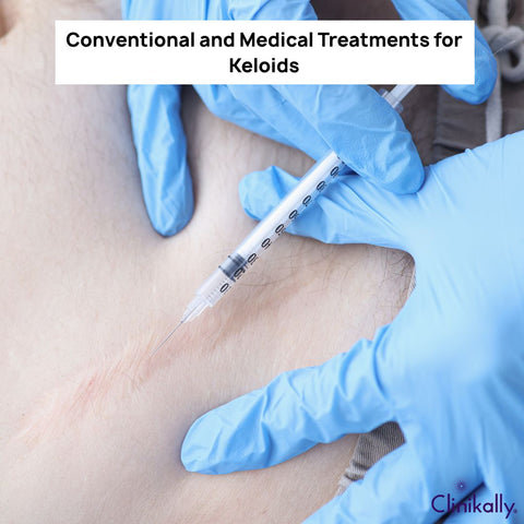 Conventional and Medical Treatments for Keloids