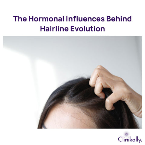 The Hormonal Influences Behind Hairline Evolution