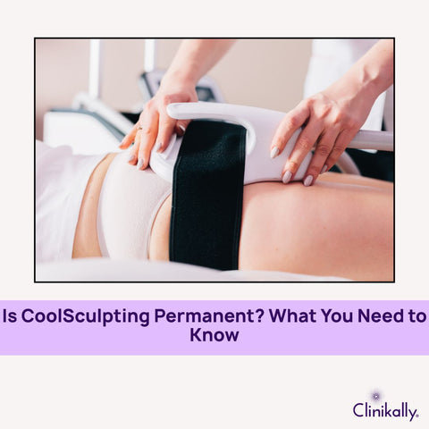 Is CoolSculpting Permanent? What You Need to Know