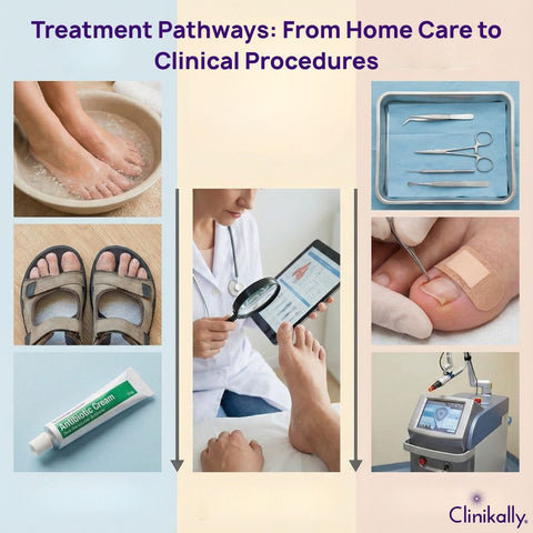 Treatment Pathways: From Home Care to Clinical Procedures