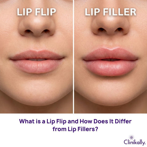What is a Lip Flip and How Does It Differ from Lip Fillers?