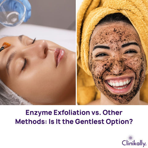 Enzyme Exfoliation vs. Other Methods: Is It the Gentlest Option?